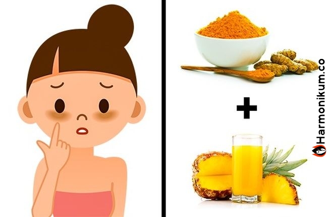 Pattanások, karikás szemek, leéégés! A Nagyi tippjei mindenen segítettek! Ne felejtsük el a régi tudást!