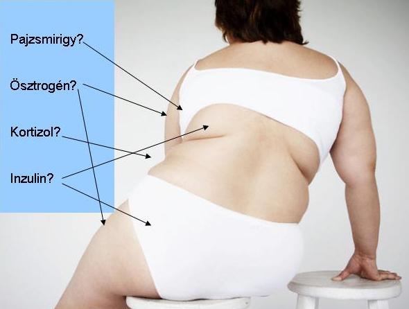 Kiborultam, amikor a doki elmondta, mitől hízom! Te gondoltad volna ezt?