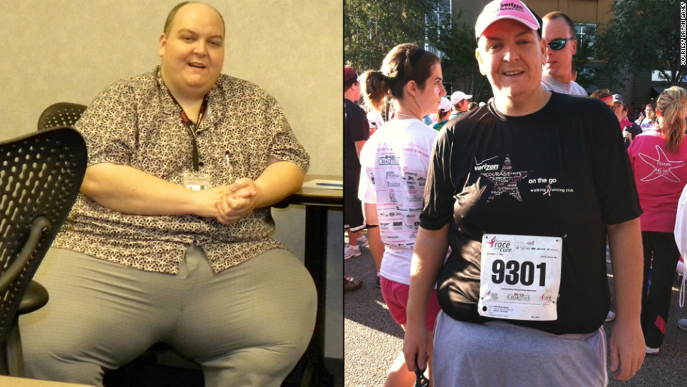 A férfi megtagadta a műtétet, 120 kilót fogyott ezzel a keverékkel